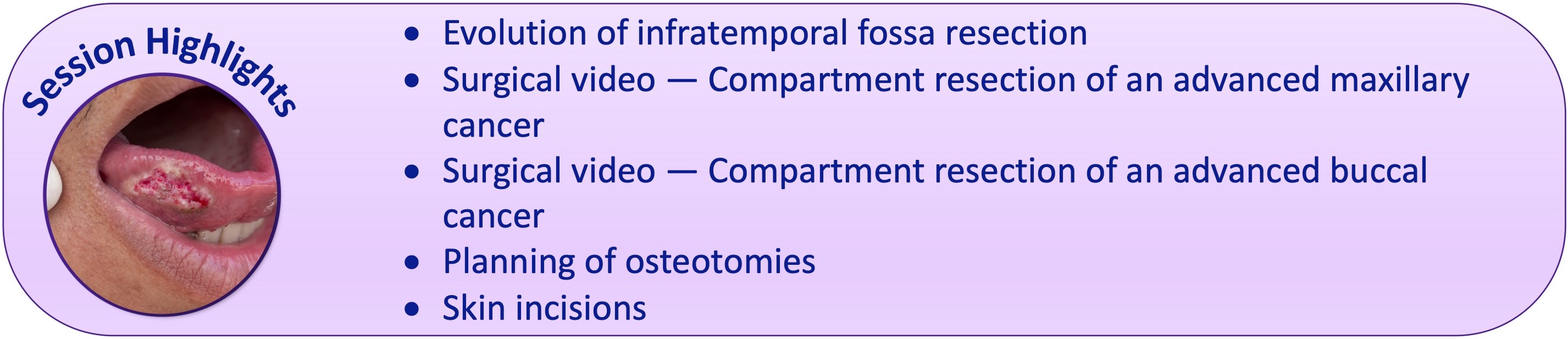 Compartment Resection of Advanced Buccal Cancer